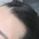 뷰티헤어라인 네이버블로그