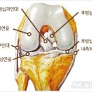 무릎에서 ‘뚝' 소리나고 통증·붓기 있으면 '이것' 의심 이미지