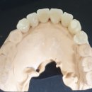 지안치과기공소 이미지