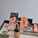 소성로 | 미추홀구 이어테라피 잘하는곳: 염색앤두피(두피관리, 이어테라피 후기)