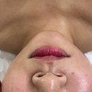 세븐일레븐 일산마두힐링점 | [일산/마두] '리글로우에스테틱' 스페셜 윤곽관리 솔직후기 (비포애프터포함)