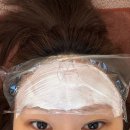 제15회 하남예술제 | 이마필러 리터치까지 일자이마 필러 후기