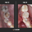 수치과기공소 이미지