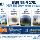 청아약국 네이버블로그