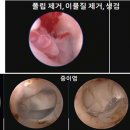베트컴코리아(주) 네이버블로그