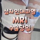 서부성모의원 | 갑작스러운 십자인대 파열, MRI 촬영 비용 수술 입원까지 일사천리 진행 후기