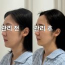 정자역 피부관리 뷰티디안느 분당정자본점 이중턱 고민 티리온-X로 타파하고 온 솔직 후기