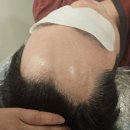 영통 두피관리 두피밥 방문 후기