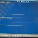 스마일카센타 이미지