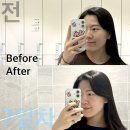 수성전자 | 대구 리투오 잘하는 곳, 대구 수성구 피부과 내돈내산 솔직후기!