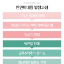 3D안면비대칭교정
