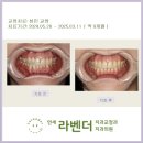 연세라벤더치과 4월 성인교정 후기