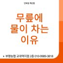 의사가 직접 알려주는 40~50대 여성을 위한 한달만에 쉽고 건강하게 5Kg 빼는 법 | [계산동헬스장] 무릎에 물 차는 이유 총정리 | 운동으로 예방하는 방법