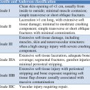 터미널 개방 이미지
