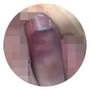 김포튼튼척의원 | [김포정형외과 추천] "김포튼튼척의원" : 세상 쉬운 발가락 골절 후기♬♪