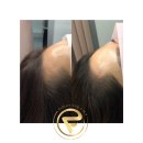 라인헤어 이미지