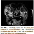 Zygomatic Salivary Gland Diseases in the Dog Three Cases Diagnosed by MRI 이미지