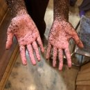 금화한의원 | 제주 효소찜질 피부관리엔 금화효소원 제주점 효소찜질 후기