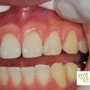 민치아치과기공소 이미지