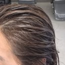 엘림메디칼 | 청라미요일 클리닉 1~5단계 " 아벨라움 청라 " 단백질케어