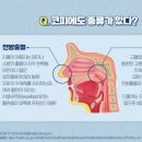 코피 원인 자주 나는 이유는? 멈추는 법 이미지