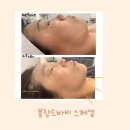 블랑드바비 이미지