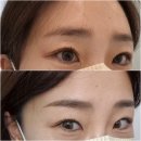 송파 니니브로우 저통증 눈썹문신 대박임 진짜후기 (5일차, 8일차 후기도)