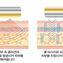 핫쿨테라피