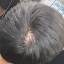 새튼튼약국 | 로게인폼