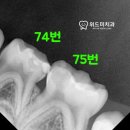이75덴탈 이미지