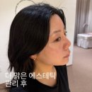 우리동네힐링샵 창원중앙점 | 창원피부관리 고민이라면, 더맑은스킨 창원유니시티점 1:1 맞춤관리 후기
