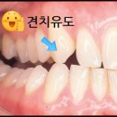 튼튼유도 이미지