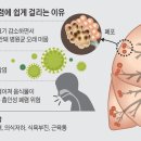 노인, 감기로 착각해 "폐렴" 방치했다가 사망까지.... 이미지