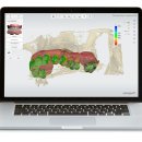 올바른치과기공소 이미지