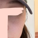 티타늄 리프팅 &amp; 온다 &amp; 올레웨이브 내돈내산 후기