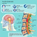 운동요법 이미지