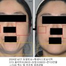 스프링봄봄