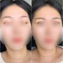 일산 눈썹 반영구, 잔흔커버 잘하는 &#39;아이브&#39; 찐 만족 후기