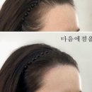 마음에점을찍다두피SMP 이미지