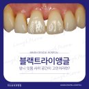사이공간엘