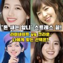 크라운삼겹살 | "돈 새는 앞니" 때문에 사진 찍기 싫다면? 라미네이트 vs 크라운 치과 상담 후기