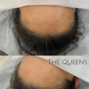 퀸즈헤어라인