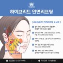 가미성형외과의원 네이버블로그