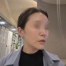 바이린의원 | [중랑구피부과] 바이린의원 슈링크 유니버스+볼뉴머 리프팅 '볼링크' 찐후기(+제네시스·피코토닝)