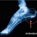 이훈구한의원 네이버블로그