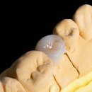 네츄럴치과기공소 이미지