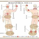 아토피 치료 이미지