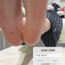 제이루리 | 여름 준비 창원 상남동 발각질제거 내돈내산 후기 에디뷰티 제이루리
