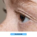 SNU하안과의원 이미지