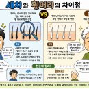 8월4일 공학여지도211 : 새치와 흰머리 차이점 이미지